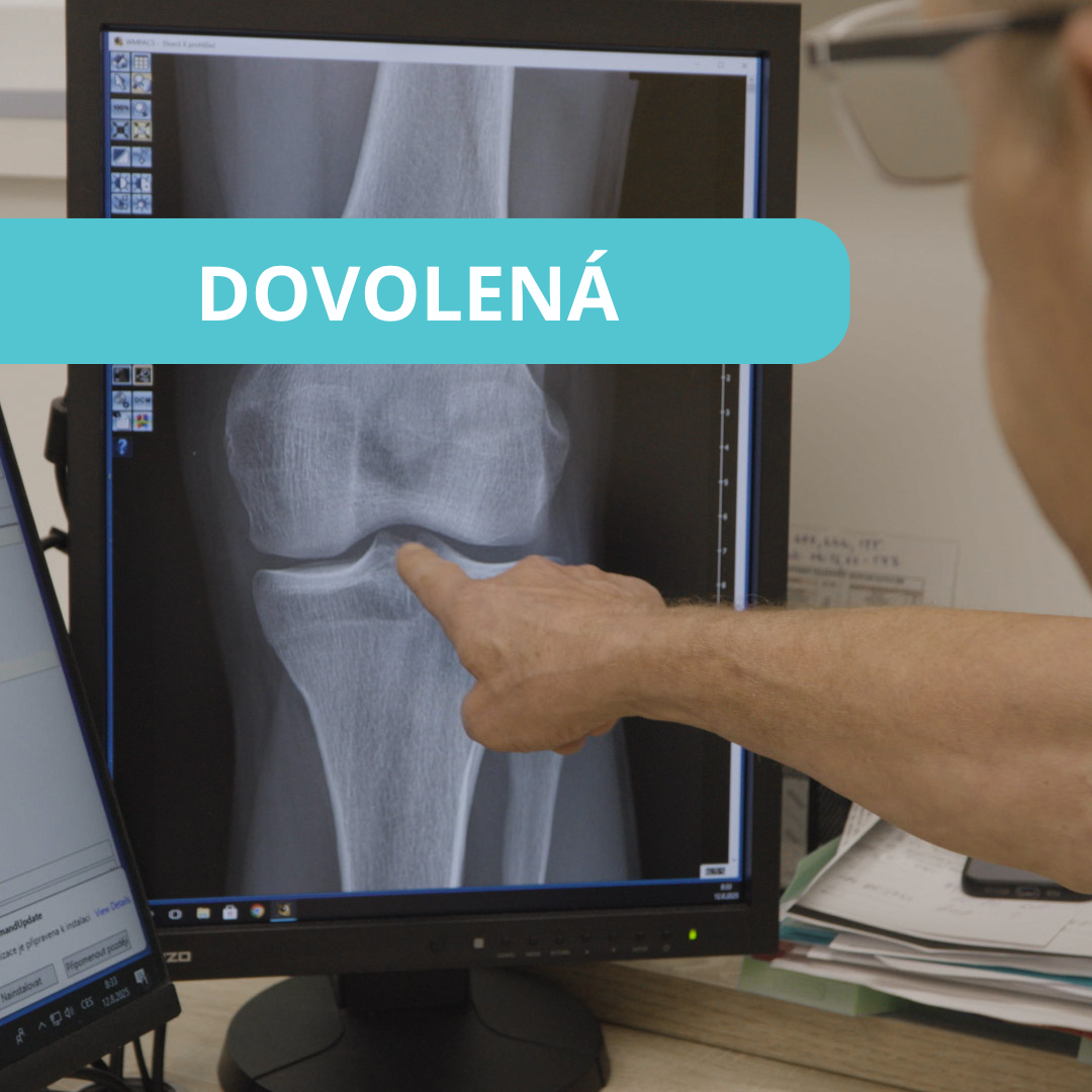 Novinky - Dovolená v ortopedické ambulanci